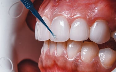 Foods that damage teeth